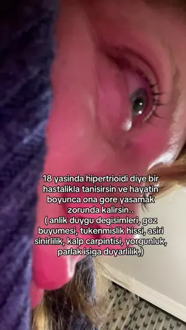 stresten uzak bir hayat istiyor hastalik ama ben stresin ta kendisiyim🙂