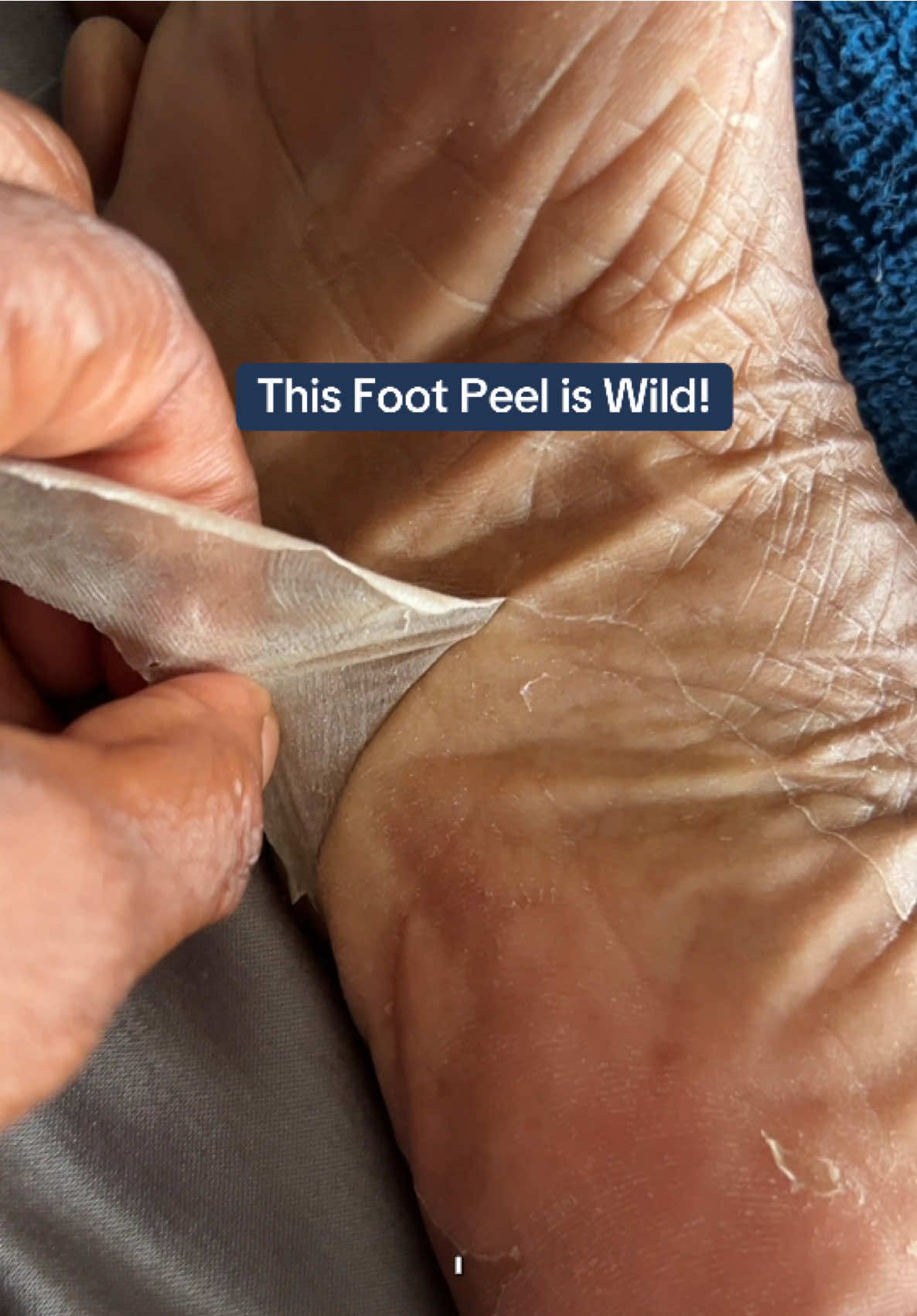 This foot peel sheet mask works!! #creatorsearchinsights #footpeel #footpeelmask #peelingskin #footpeelingmask #ttstastemakers #may #Summer #spring #BeautyTok #summervibes  #TikTokShopMemorialDay