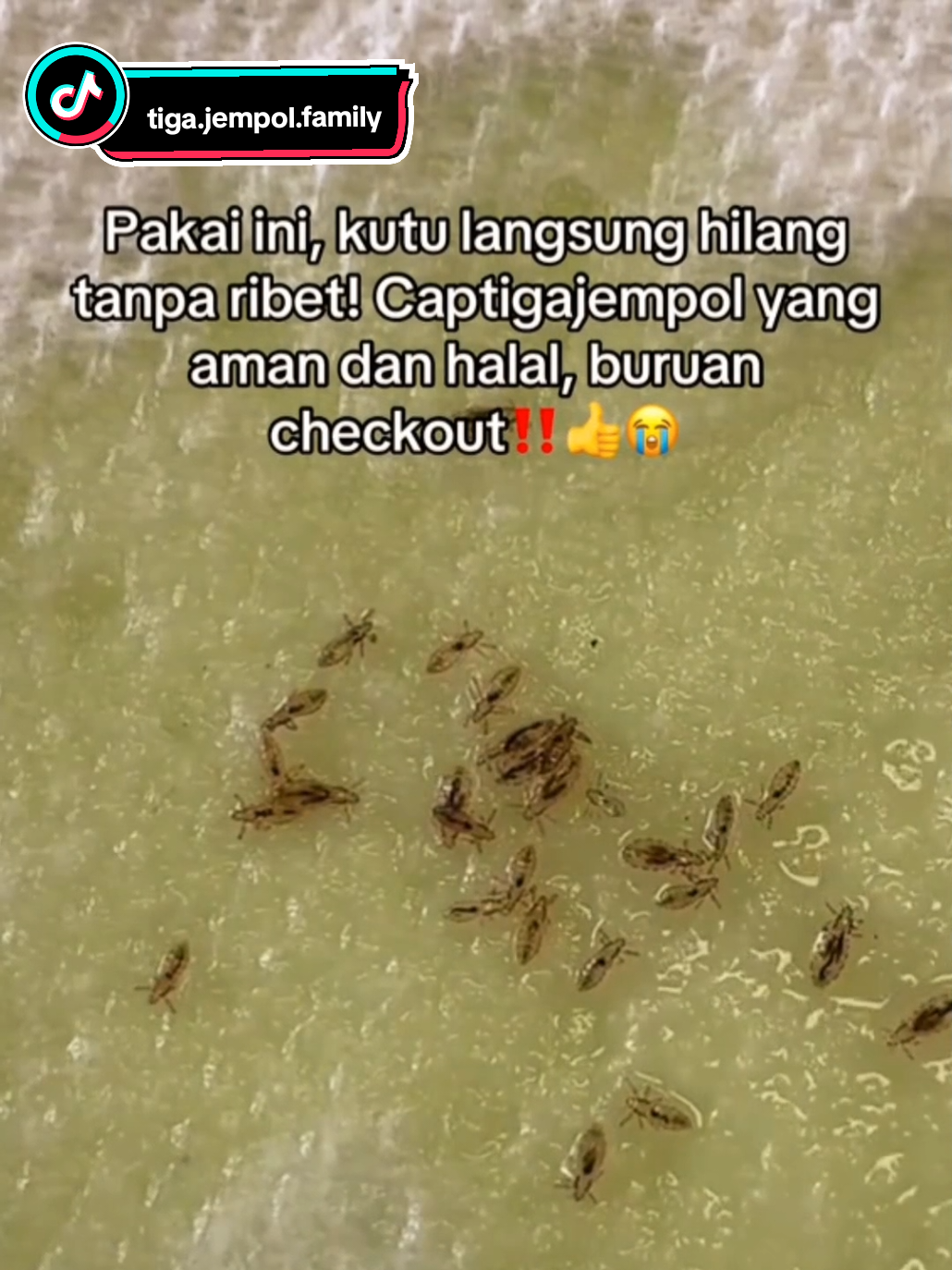 Bagian 10 #CapCut #pembasmikutu #obatkuturambut #obatkutuampuh #captigajempol #minyakkuturambut #mayday #mei #fyp #beranda #viralditiktok #fyppage #fyppppppppppppppppppppppp #obatkutu #velocity 