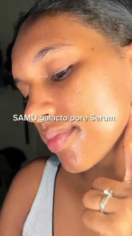 😳🙀 @SAM’U #cakemakeup #riceyeasttoner #ricetoner #poros #poreserum#sebum #samu #galactomyces #glassskin #cloggedpores