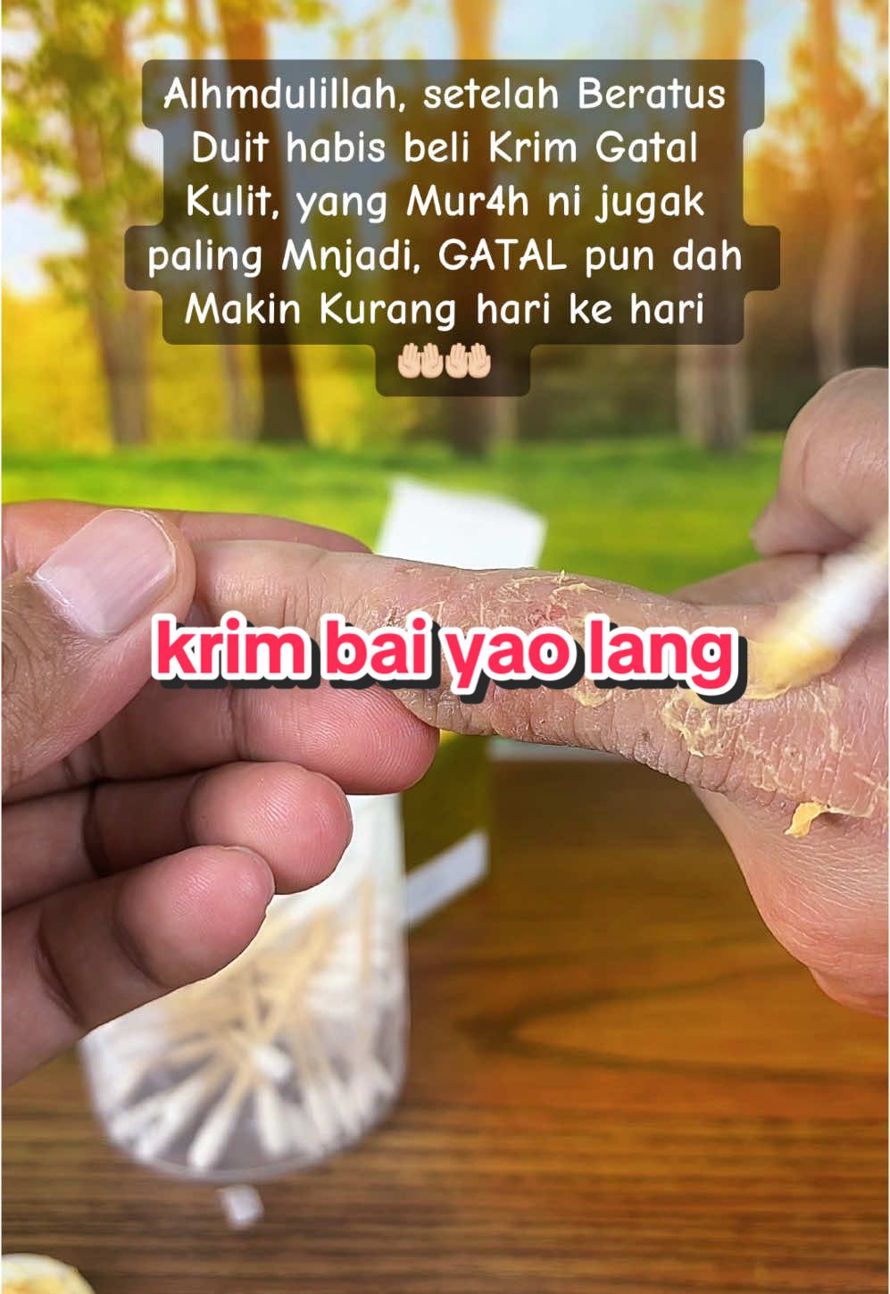 Berbaloi betul sapu krim bai yao lang ni, menyesal tak jumpa awal2 dulu, gatal sekarang pun dah mulai kurang hari ke hari #krimbaiyaolang #krimgatalkulit #krimgatalviral 
