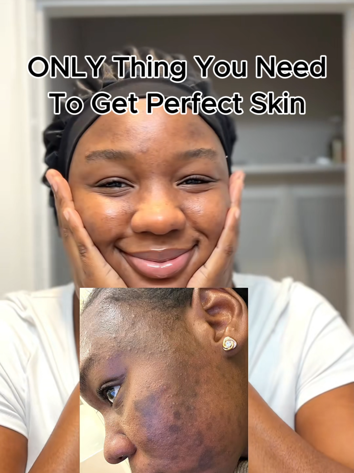 Say bye to dark spots on your skin...
