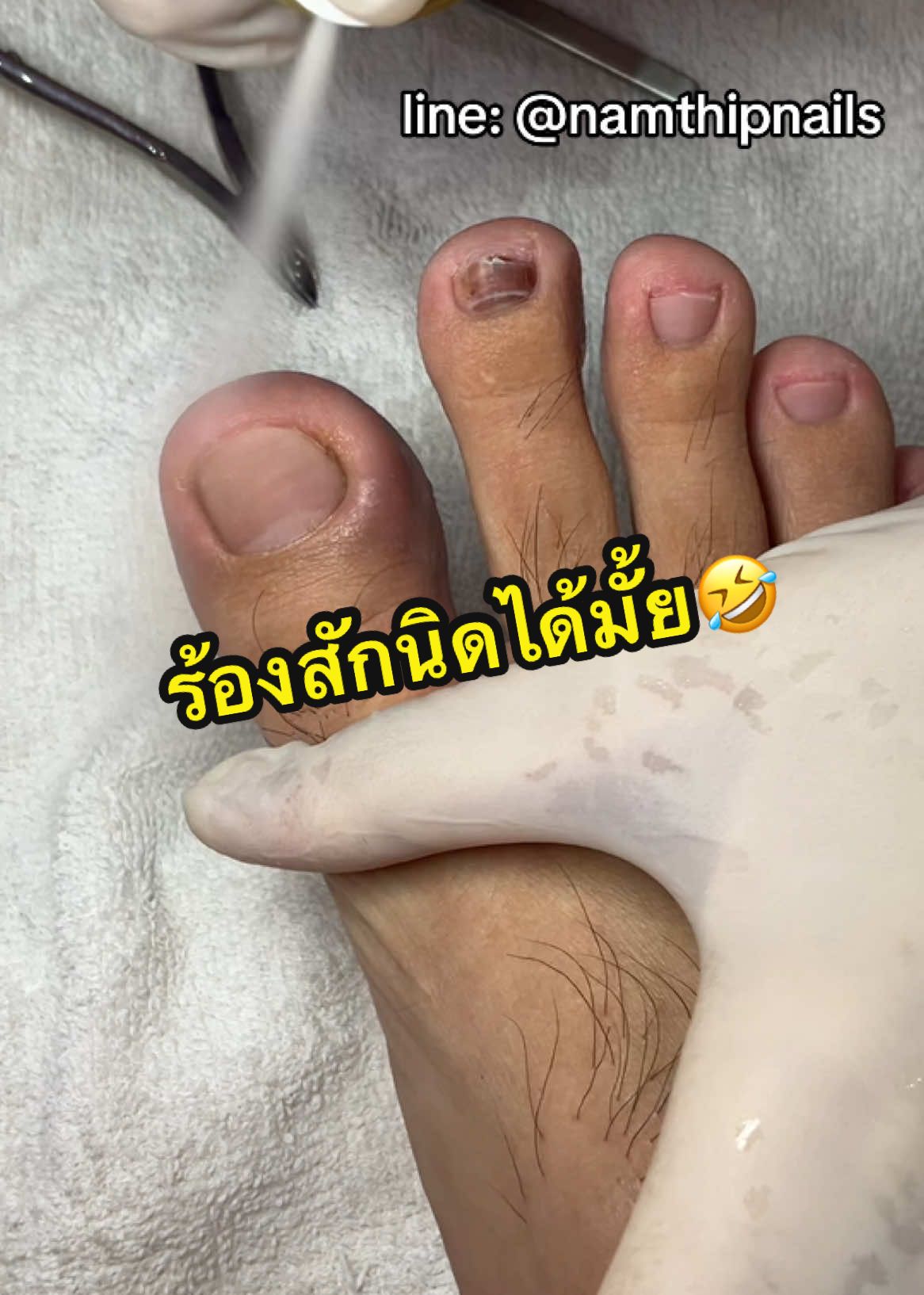 💓 #namthipnails #ตัดเล็บขบ #ตัดหนัง #ทำเล็บ #ร้านตัดเล็บขบ #ร้านตัดเล็บขบราม2 #ตัดเล็บ #เล็บขบ  #เล็บเชื้อรา Fb : namthipnails  Line : @namthipnails  นัมเบอร์วัน8 ตลาดม.ราม2  กทม  Map: namthipnails  https://goo.gl/maps/JmwpCKLfKwmhKGK96  ร้านเปิดทุกวัน เวลา12.00น-22.00น.