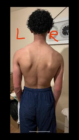 Una buena postura ya no es un objetivo, es un estilo de vida！.🏃🏃 #posturecorrection#Hunchback#healthylifestyle#posturecheck#backpainrelief#posturecorrection#fyp#posturecoach#tiktokmademebuyit#goodposture#fixyourposture