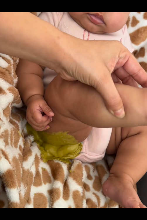 Baby poop#foryou #funnyvideos #baby#poop #funnyvideos #babypoop