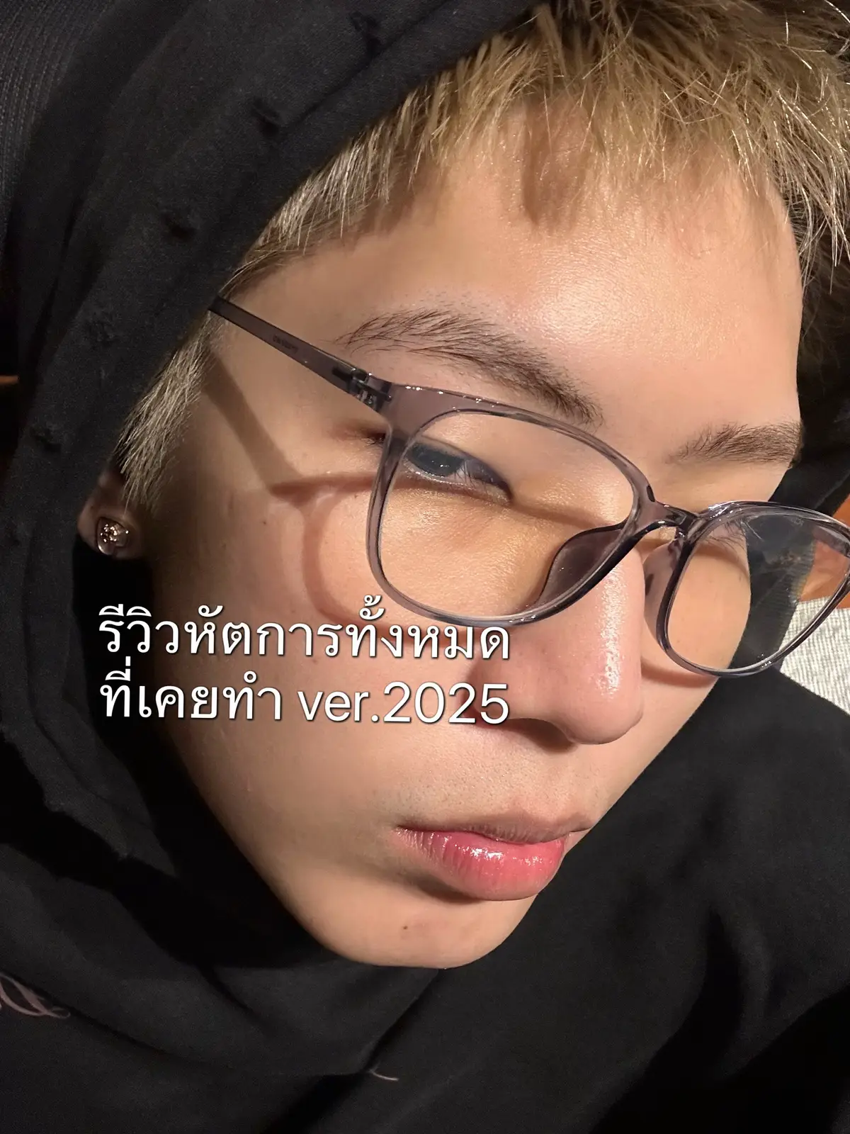 #รีวิวหัตถการ #fyp 