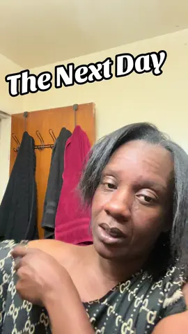 Just showing y’all this happens everyday it’s never ending!!!! #BlackHairCare #HealthyHair #Dandruff #seborrheicdermatitis #StruggleIsReal 