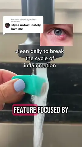 Stye Cleansing System ❤️‍🩹