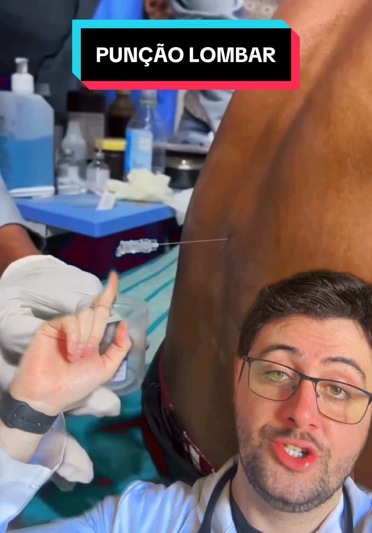 PUNÇÃO LOMBAR #curiosidades #curiosidadesmedicas #medico #medicina #cerebro #meningite #infecção 