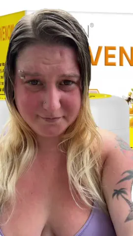 This bee venom cream is magic in a jar! Tightens, smooths, and gives your skin that natural glow — no sting, just results. You won’t believe the before and after! #BeeVenomCream #GlowUpSkincare #TikTokShopFinds #YouthfulSkin #SkinTightening #BeeVenomBeauty #NaturalGlow #SkincareRoutine #AntiAgingHack #ViralSkincare