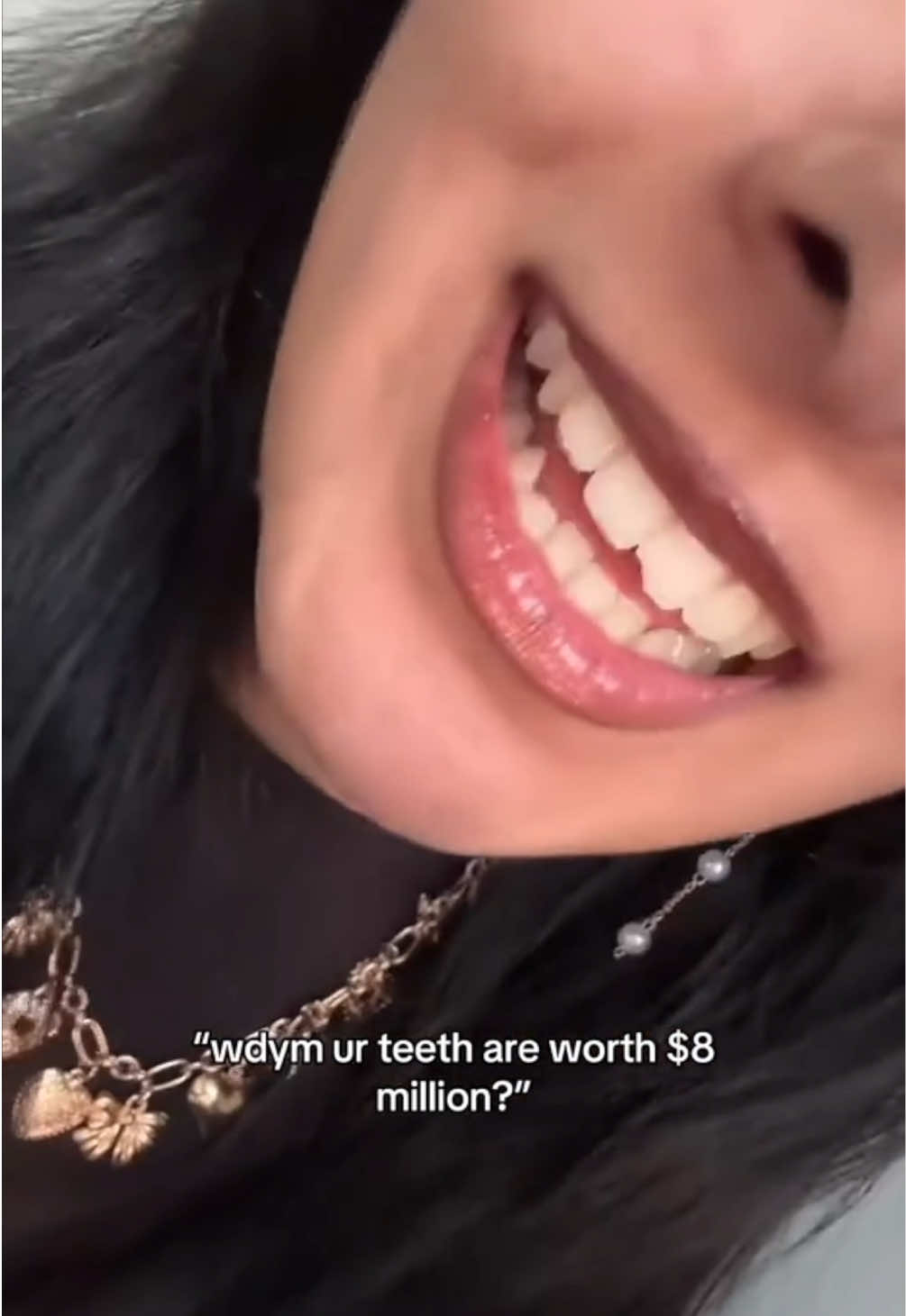 Nail-biting might seem harmless… but your teeth beg to differ. 😬💅  It’s one of the most common habits I see—and over time, it can lead to worn enamel, chips, and even cracks. The good news? We’ve got solutions. 👉 Whether it’s minor cosmetic bonding, enamel build-up, or full porcelain veneers—we’ll customize the best treatment to get your smile back on track. 💫 Bite your burger, not your nails 🍔😂 - Book an appointment with us 👇 Call us 📞 858-314-3172 📍 4765 Carmel Mountain Rd., Suite 203, San Diego, CA 92130 💻 - elghordentalstudio.com #dentist #elghordentalstudio