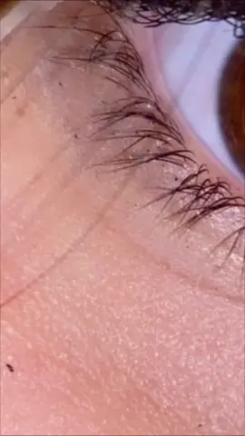 #fppppppppppppppppppppppp❤️  ❤️‍🩹💍🥺