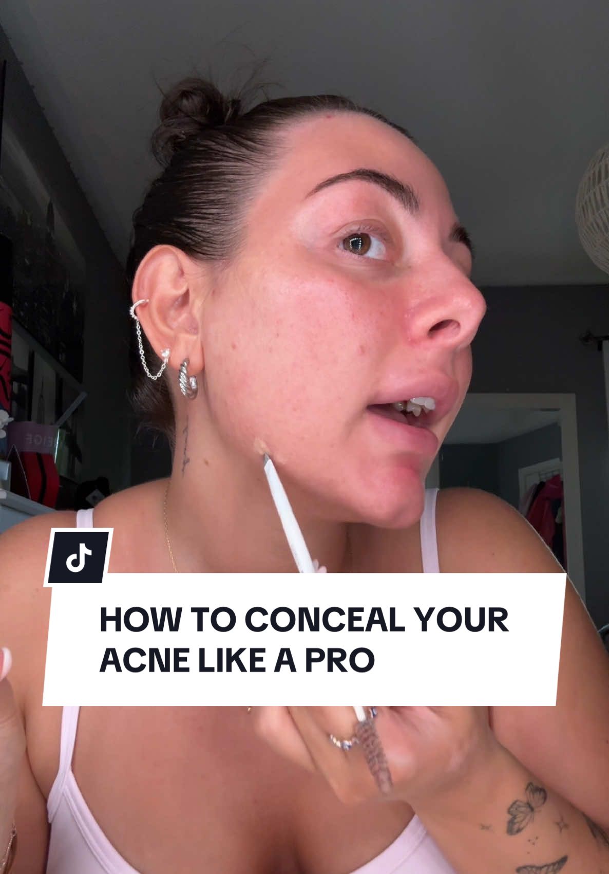 This is how to PROPERLY conceal your acne & blemishes.. @Fenty Beauty @NARS Cosmetics @Rare Beauty @Morphe Cosmetics @Supergoop @Haus Labs by Lady Gaga #izzystipsytuesdays 