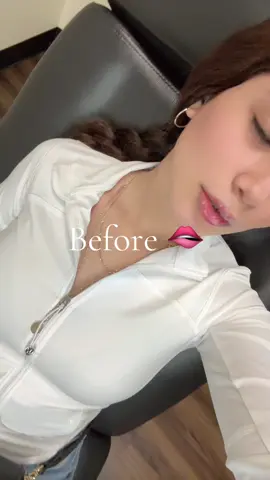@NakedMD™️ #loved#fypシ 