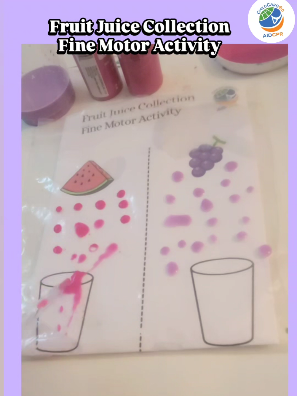 ☀️🍇 🍉 The season of summery drinks and lemonade is almost here! Download the free resource from the link in our profile to try this fruit juice fine motor activity.  Tag ChildCareEd on your post and follow for unique activity ideas. #summeractivitiesforkids #finemotoractivitiesforkids #childcareeducator #summerbreakcountdown  #earlychildhoodeducators #finemotorfun #earlyeducationstartsathome #childcareproviders #earlyeducation  #finemotordevelopment  #sensoryactivitiesforkids #childcareteacher #childcareprofessionals #eceteachers #childdevelopmentassociate #earlychildhoodeducation #daycareprovider #preschoolteachers #childdevelopment #montessoriteachers #marylandeducation #educatorsrock #explorepages✨ 