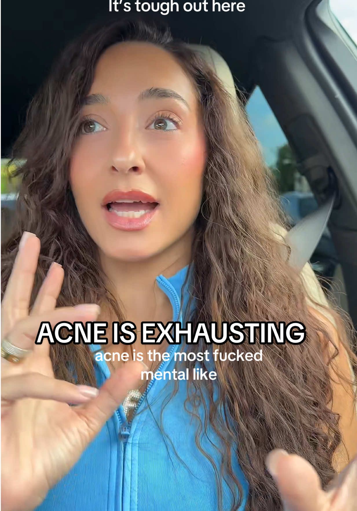 I had acne for a decade it’s EXHAUSTING .. #acne #acneproneskin #hormonalacne #acnescars #acnetreatment