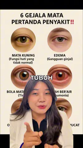 Mata👀 bisa nunjukin kesehatan tubuh kamu loh‼️ #mywell #kesehatan #infokesehatan #mata #health #tubuh #tubuhsehat #fyp #foryou 