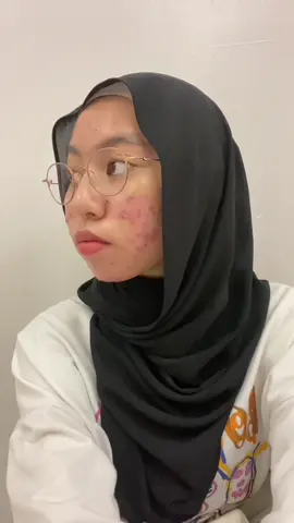 Replying to @suka dumpling  Clear skin takes time and consistency. Be patient with yourself. Jangan lupa hydration and consistent are the keys. Ive been struggling since 2022 till now. At least dapat lah tau siapa yang ikhlas dengan kita :(  1. amway bio c plus 2. cosrx low ph cleanser 3. tps toner hydration  4. numbuzin 5+ serum (my fav) 5.purito moisturiser bamboo & oat calming gel cream 6. tps invisible sunscreen 7. facetology tinted sunscreen 8. wawa tinted sunscreen #acnefighter #acne #acnejourney #skincareroutine #clearskintips #skincaremalaysia #tiktokmalaysia #fyp #foryou #GlowUp #relatable #xybca 