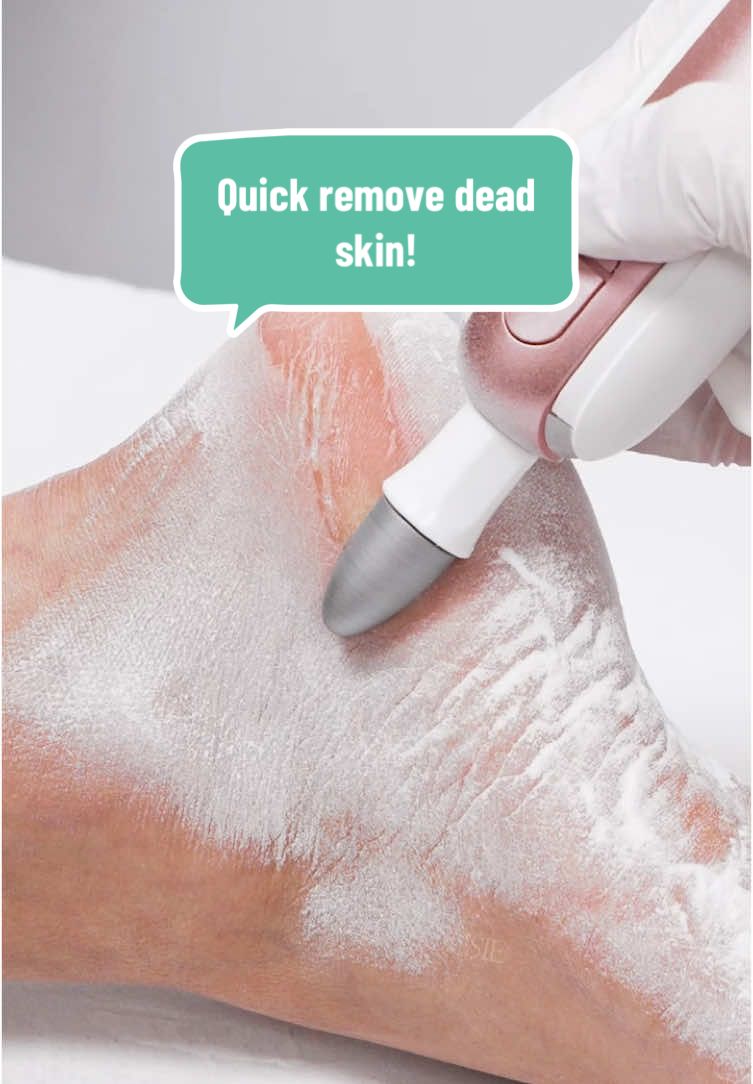 Quick remove dead skin! Try PC760G Manicure & Pedicure Nail Drill! It can remove dead skin easily! #melodysusie #melodysusienails #nailtools #nailart #nailchallenge #nailtutorial #nailtechlife #nailtechcheck #nailtechproblems #nailtechnician #nails #nailbeginner #nailpro #naillover #nailhack #nailtips #nailtip #nailtools #naildrill #nailtok #nailsoftiktok #pedicure 