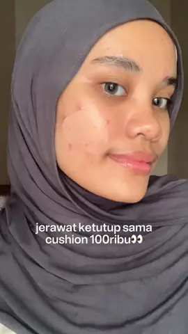 jerawat & kemerahan aku pada kemana ini heyy‼️ kalau soal coverage mah skintific si biru ini gak usah diraguin lagi🩵 #cushion #cushionviral #skintific #mattecushion #redness #acneproneskin 