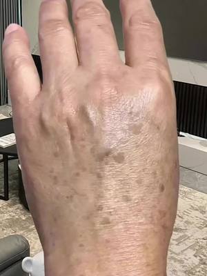 Dark spots? Sun spots? This cream works like magic!  013