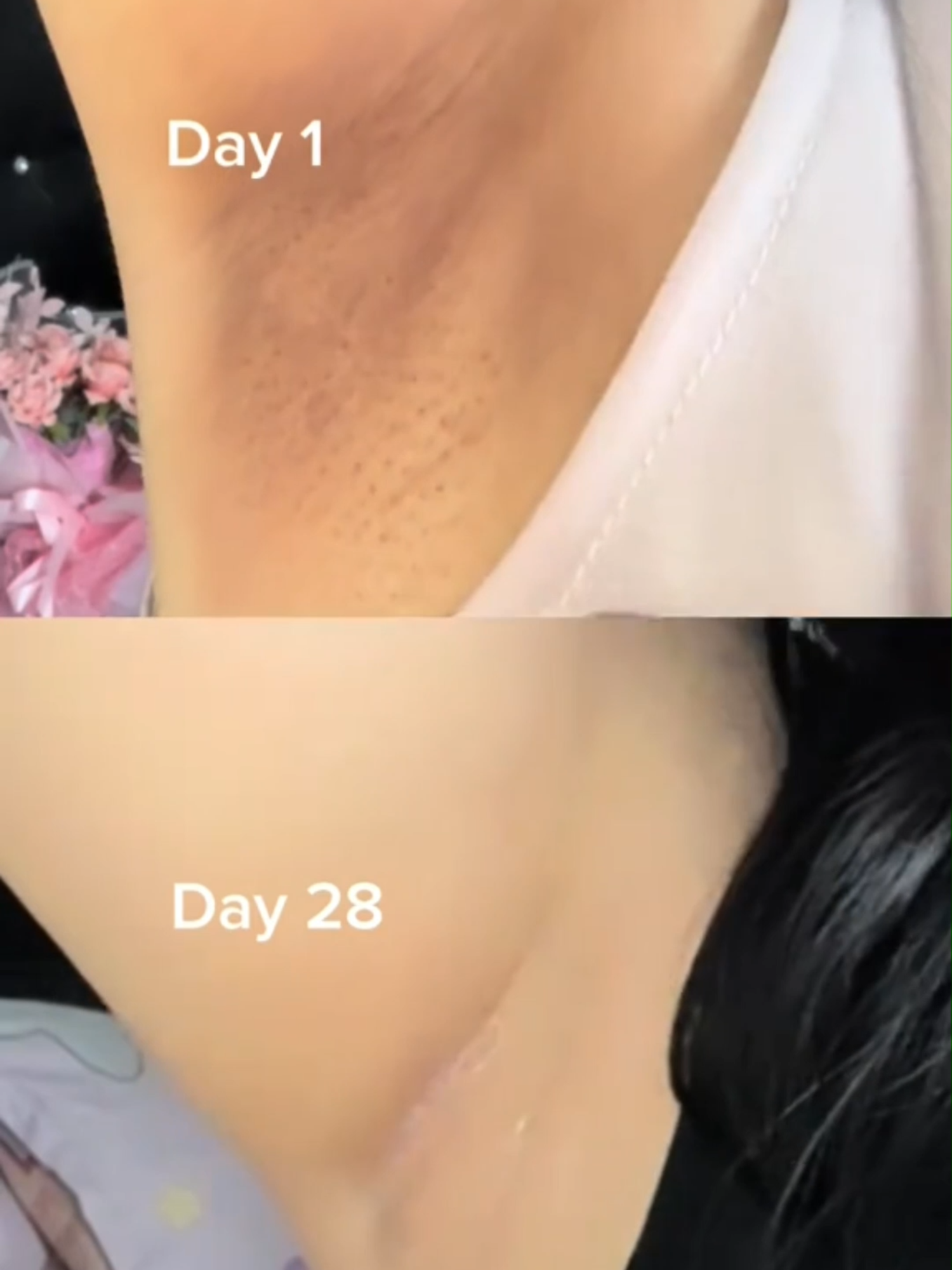 #enmora #underarm #ketiakglowing #creamunderarm #susukmacan #mamacantik