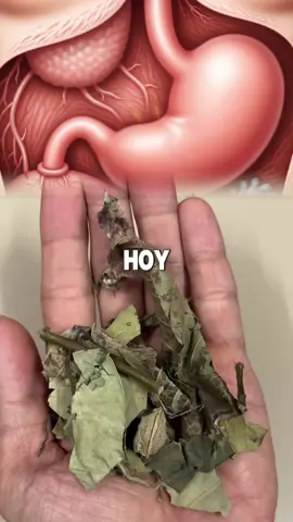 ¡Despídete de la acidez y dispepsia en solo minutos! ⏳🌿 #remediosnaturales #saludnatural #digestivo #fyp #viral #foryoupage