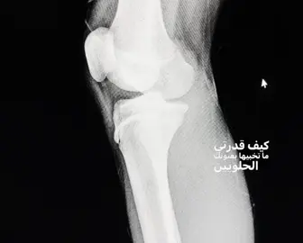 #CapCut #هيه#الرغبه#موجوده#بس#الركبه#ماساعد#مالي_خلق_احط_هاشتاقات #كره_القدم_قصه_عشق_لاينتهي#ريال_مدريد 