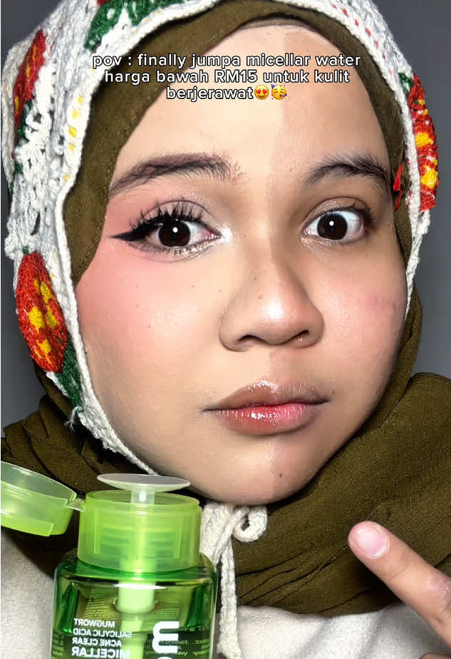 My fav micellar water!!! Dah la harga rahmah pulak tu😍 LURVEEE!!!! #AcneMicellarWater #Glad2Glow #bestmicellarwater #micellarwater 