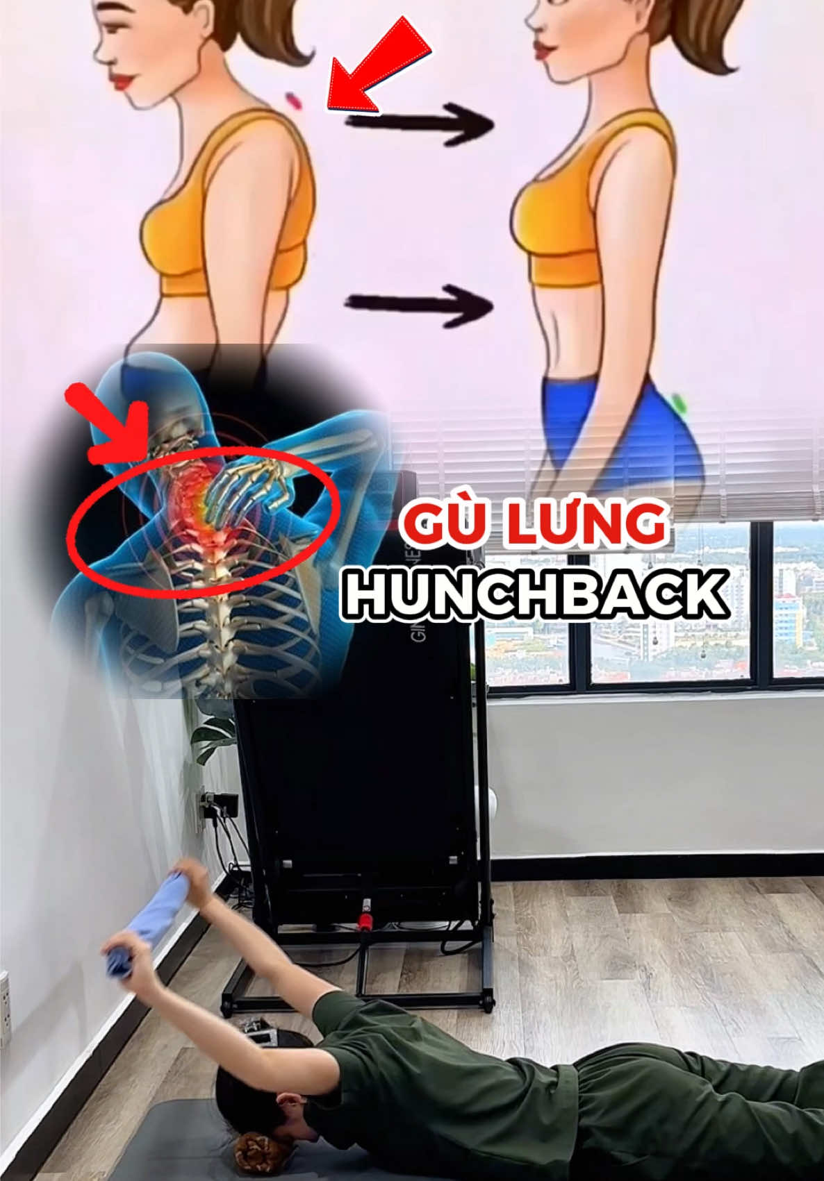 Cải thiện tư thế, giảm nhanh cơn đau vai gáy, ngừa thoái hoá cột sống hiệu quả. #baitapcovaigay #bsngocoi 