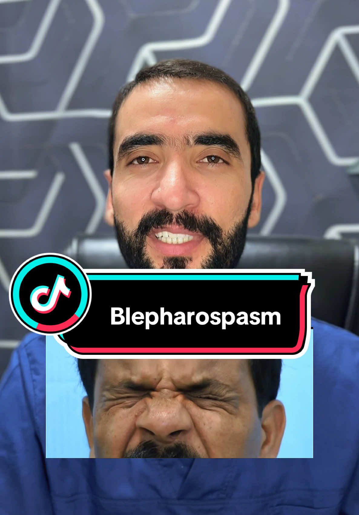 Blepharospasm Causes, treatment and Risks by Dr Adnan Khan #dradnankhan #dradnskincare #pashtotiktok #healthawareness #pakistan #blepharospasm #eye 