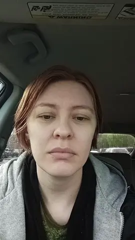 #ehlersdanlossyndrome #hippain #labrialtear they did note that there's something up with the tissue around the ball of my hip but said it's the same as when I had my labral tear 