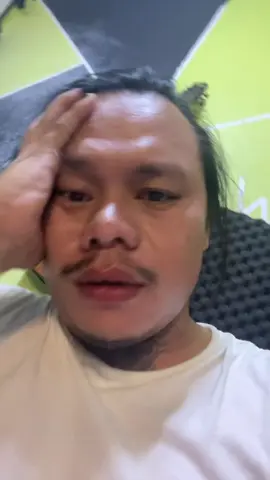 Monkey pox napud😭