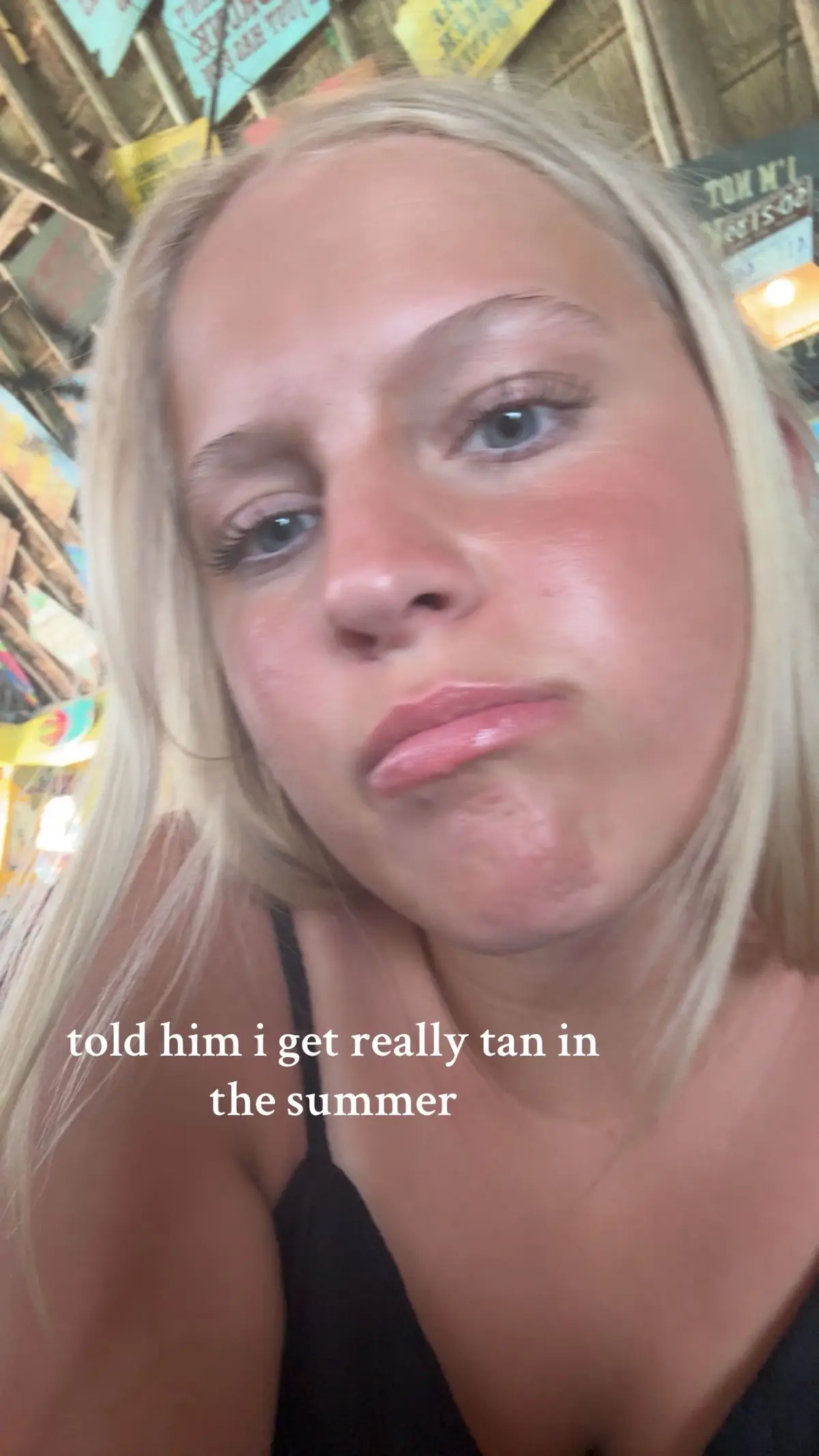 #tanlines #Summer #tanning #vacation #fyp #goviral #abcxyz #like #comment #repost 