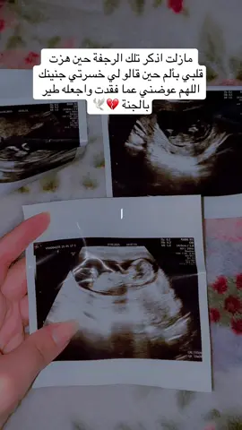 #💔💔💔💔طير بجنه ياروح أمك 💔😭