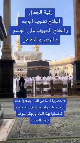 رقيه قويه لمن يعاني من سحر تشويه الجمال فاستمعوا لها بالتكرار  #بسم_الله_الرحمن_الرحيم #شفاء #رقية #رقية_شرعية #الرقية #الرقية_الشرعية #الرقية_الشرعية_من_سحر_وحسد_ومس #اقوى_رقية_مجربة_للعين_والحسد_والسحر #علاج_السحر_المأكول_والمشروب #علاج_السحر_المس_العين #علاج_السحر_الحسد #علاج_السحر_بانواعه #علاج_السحر #الحسد #الحسد_والحقد_والعين_الحاسدة #الحسد_والحقد_والعين #الحسدوالعين #الحسد_والحقد_والغيرة #العين #التابعة #التابعة_الجن_القرين #التابعة_المس_العاشق #التابعة_و_السحر #القرين #القرين_العاشق #القرين_الانثى #القرينية #السحر_الاسود #سحر #السحر #روحانيات_واسرار #روحانيات_علم_الكتاب #روحانيات #روحانيات #الجن #المغاربة 