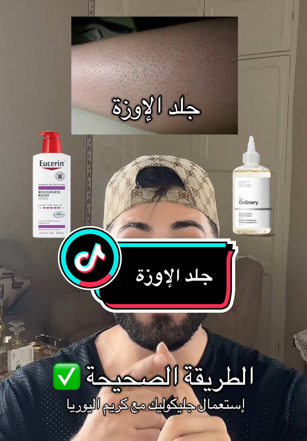 - جلد الإوزة ✅ #astucebeauté #skincare #bodycare #جلديةوتجميل 