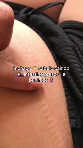 So precisava desinflamar o intestino #desinflamando #corpoinflamado #inchaçonaspernas  