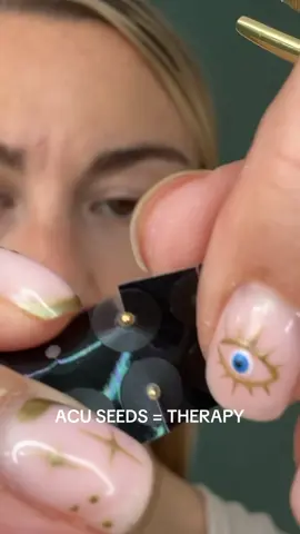 The kind of therapy you didn’t know you needed✨💛 Acu seeds are needle free acupuncture that apply pressure to specific points on the ear, helping to support a range of health concerns such as headaches, stress, anxiety, period pain and more✨  #acuseeds #earseeds #naturalhealing #stressreliever #acupressuretherapy #anxietyreliever #naturaltherapy 