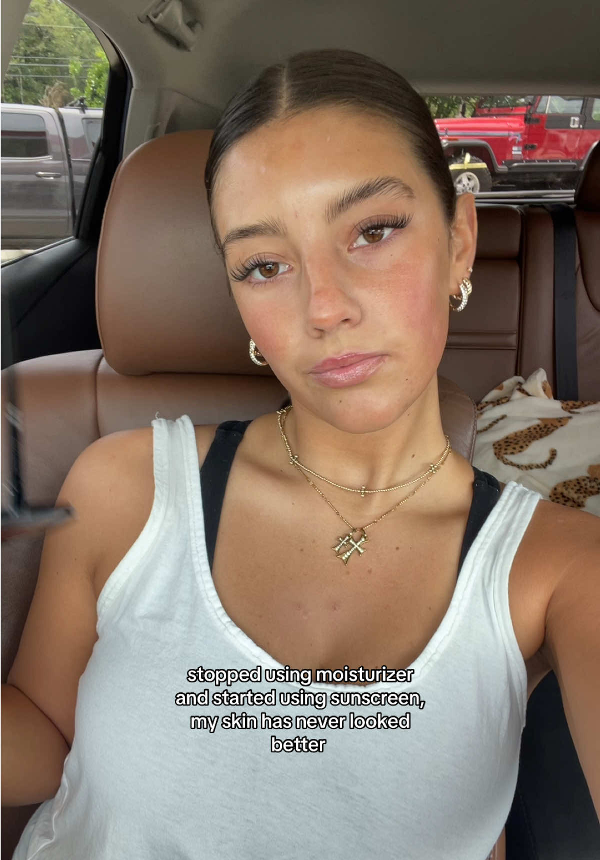 i have rosacea too but we’re getting there