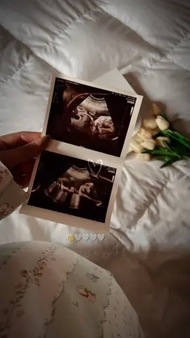 #حوامل_كيوت #حوامل_اي_شهر_صرتو_🤰🤰😍🦋 #فيهذااليوم #ولا_للحامل🥺❤️‍🔥 #يقومك_بسلامه_روحي😍❤ #حوامل_الشهر_التاسع #الحمدله_دأمن_🧿وأبدا🧿 #كليوم_فيديو🇩🇿_جديد💥💪 
