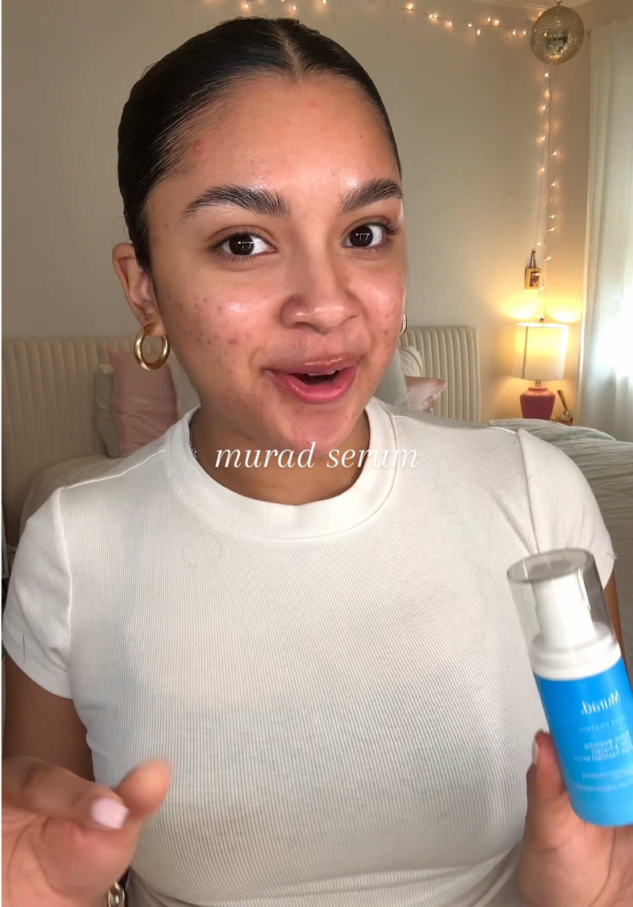 I’ve been using @Murad Skincare’s Biome-Balancing Acne Treatment Serum, and it’s been a game changer for stubborn breakouts, helping clear current acne and stop new ones from forming!💙 #muradpartner #muradskincare #murad #skincare #acnetreatment #acneproneskin #skincareroutine #acne