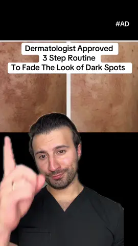 #AD Dermatologist approved 3 step routine to reduce the look of dark spots with @Eucerin US Radiant Tone Collection formulated with Thiamidol! #GlowBeyondDarkSpots #TheSearchIsOver #ExpectMoreWithEucerin #darkspots #hyperpigmentationskin  #greenscreen 