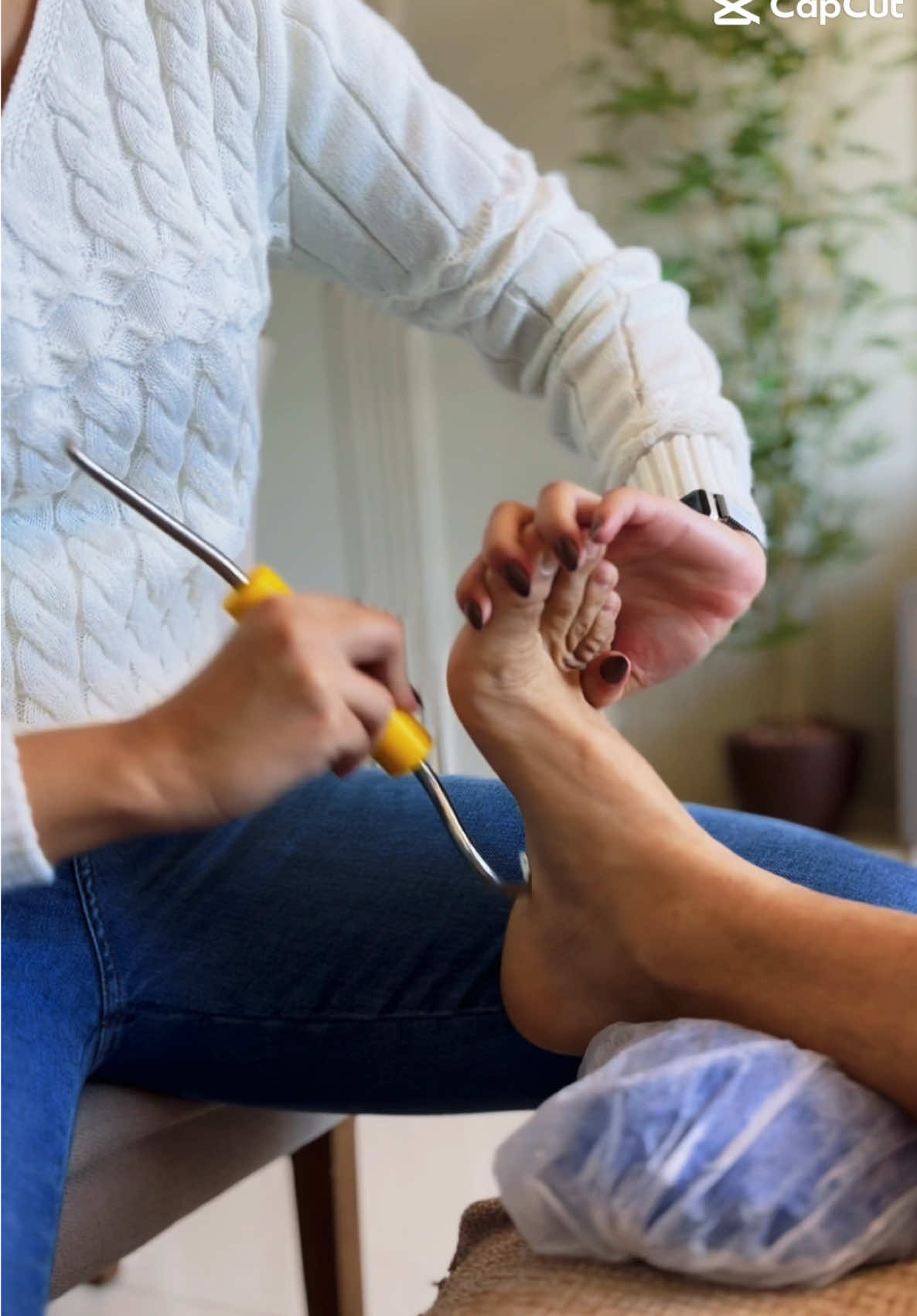 Esporão de Calcâneo e Fascite Plantar resolve sim se você utilizar as técnicas certas! A Crochetagem é uma opção incrível ❤️ #crochetagem #fisio #domiciliar #exercicioemcasa #idoso #pés #fasciteplantar #esporaodecalcaneo #virginia #zefilipe #zefelipe #reabilitacao 