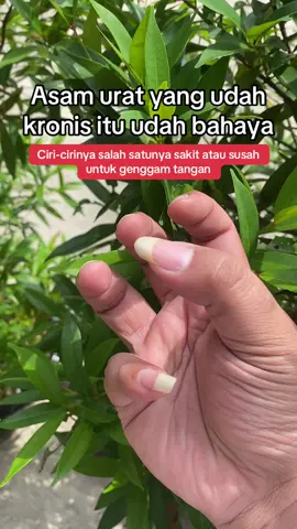Asam urat yang udah kronis itu gak cuma soal pegal. Kalau udah sampai susah buat genggam tangan, hati-hati... Itu bisa jadi tanda tophus mulai terbentuk di sendi. 📌 Ciri lainnya: * Muncul benjolan keras (biasanya di jari) * Nyeri yang makin sering kambuh * Tangan bengkak, merah, kaku * Gerak sendi makin terbatas 📌 Penyebab paling sering: * Sering makan jeroan, daging merah, dan gorengan * Minum air putih kurang * Gaya hidup gak aktif * Kebiasaan minum obat nyeri jangka panjang tanpa detoks Kalau udah gini, jangan tunda. Waktunya balik ke gaya hidup sehat lebih alami, lebih aman. #asamurat #asamuratkronis #tophus #tangansusahgenggam #detoksalami #sehatbersama