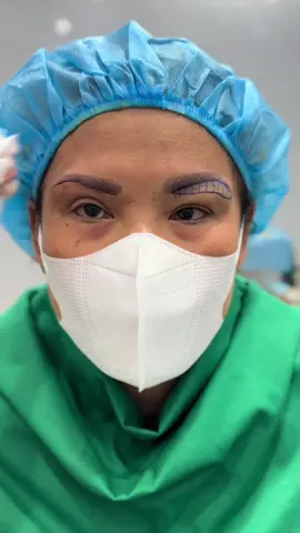 Treo cung mày dịch vụ hot tại nhà BB