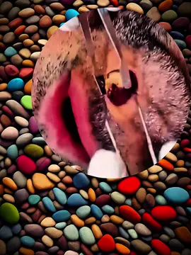#foryou #removalvideo #foreingobject #removepimples #satisfyingvideo 