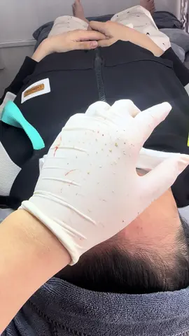 #laymunchuyensau #lamdep #xuhuong #99k 