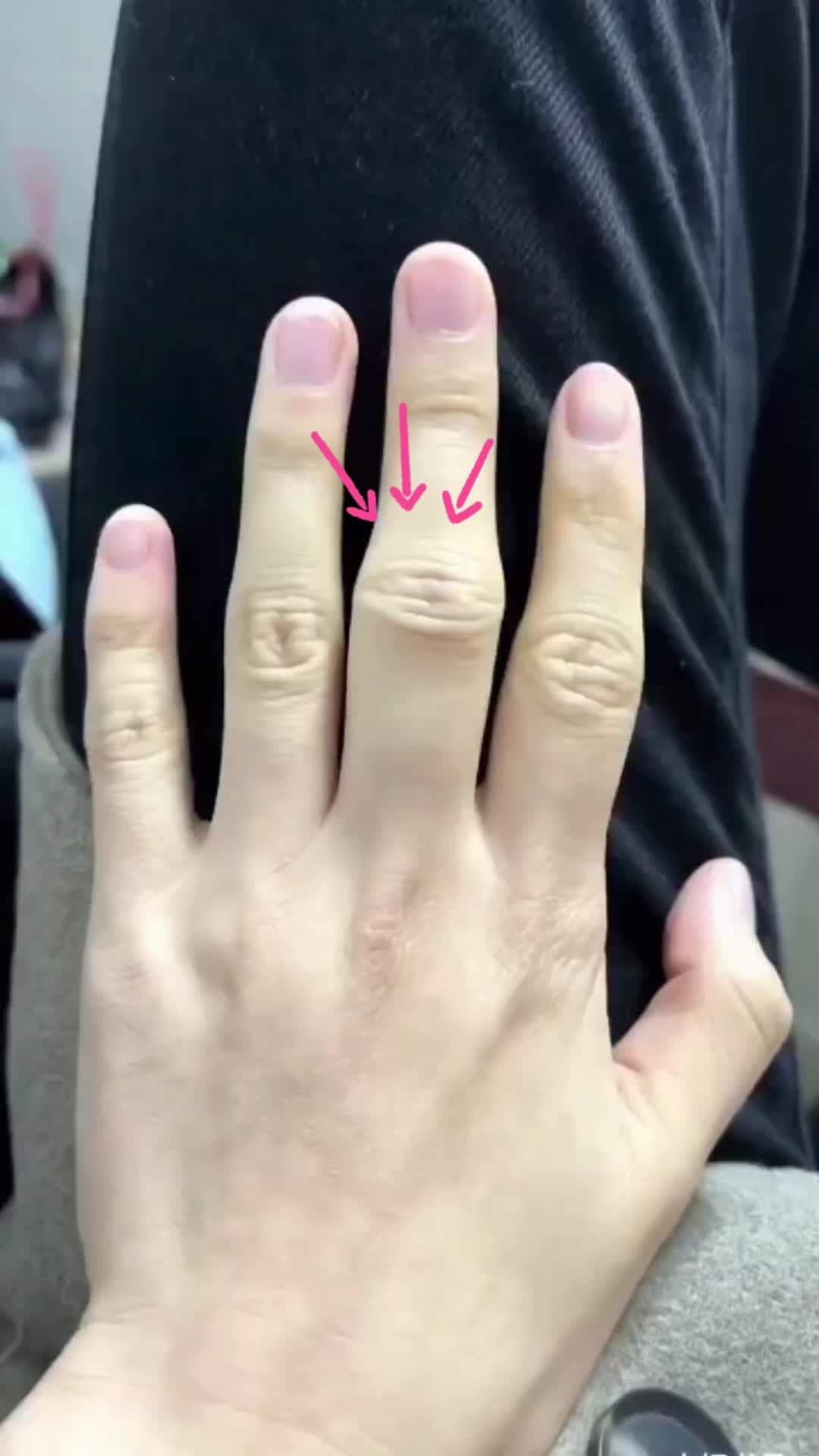 Gout Ointment,Joint Care Cream Relief Pain Joint activity Relieve Swelling Bones Massage Cream Comfort Muscle inflammation #footcare #footcream #foottreatment #jointpain #painrelief #musclereliex #treatment #fyp