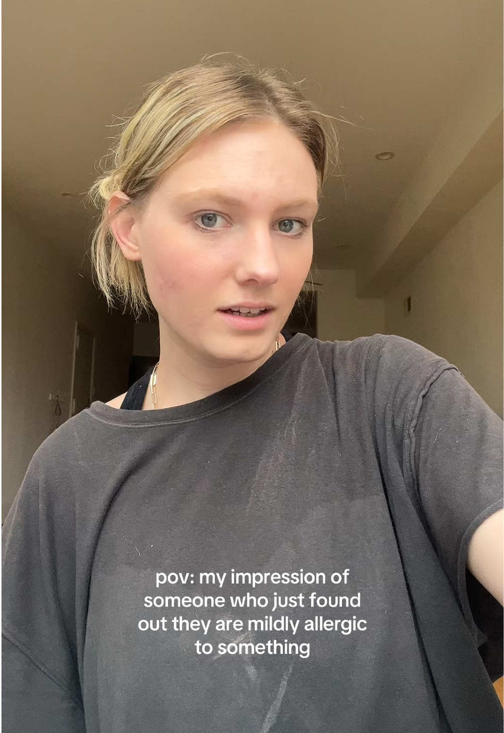 it’s me #fyp #foryou #fypシ #fypシ゚viral #viral #trend #funny #relatable #allergy #attention #trending #girlhood